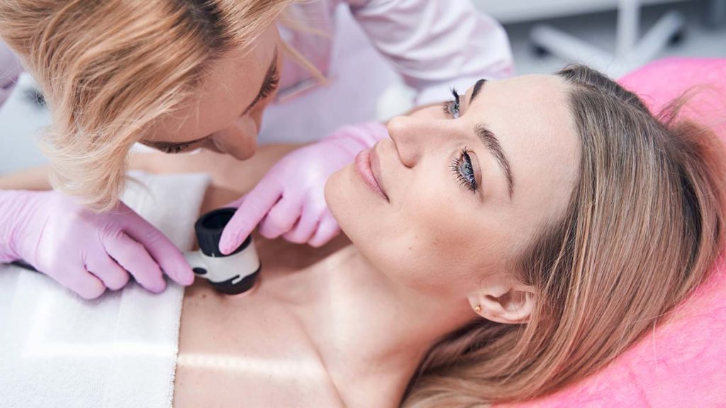 Even checken! Dit wil je weten over moedervlekken en melanomen