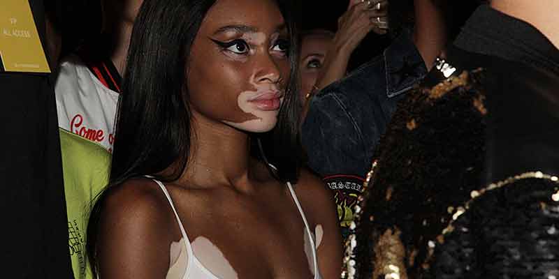 Winnie Harlow 