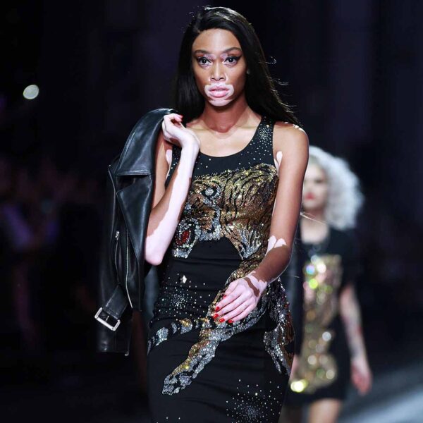 Winnie Harlow